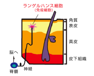 ランゲルハンス細胞